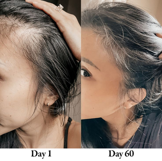 Partiküle Shower Head