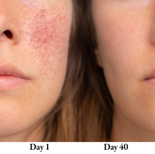 Partiküle Shower Head